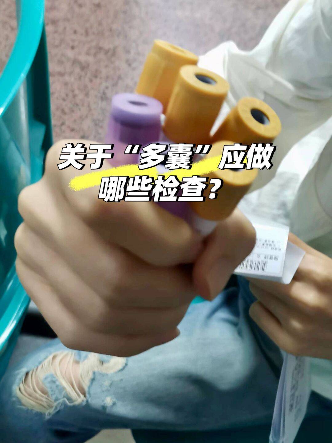 查内分泌需要做什么检查