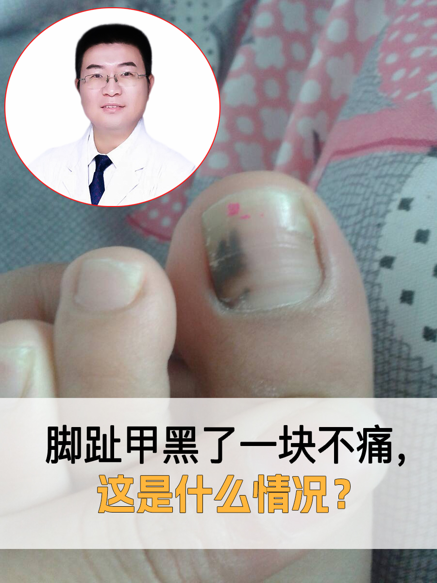 脚指甲凸凹不平是怎么回事