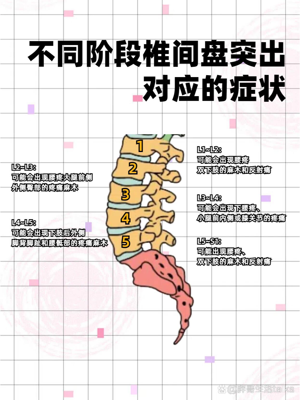 什么是腰椎间盘突出症?