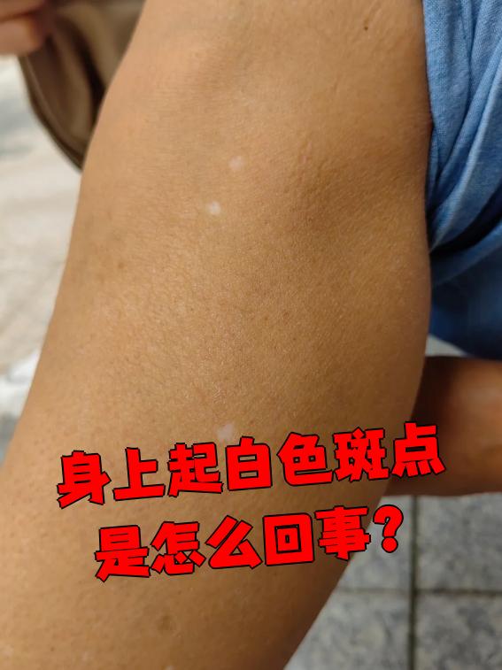 白殿病初期症状有哪些?