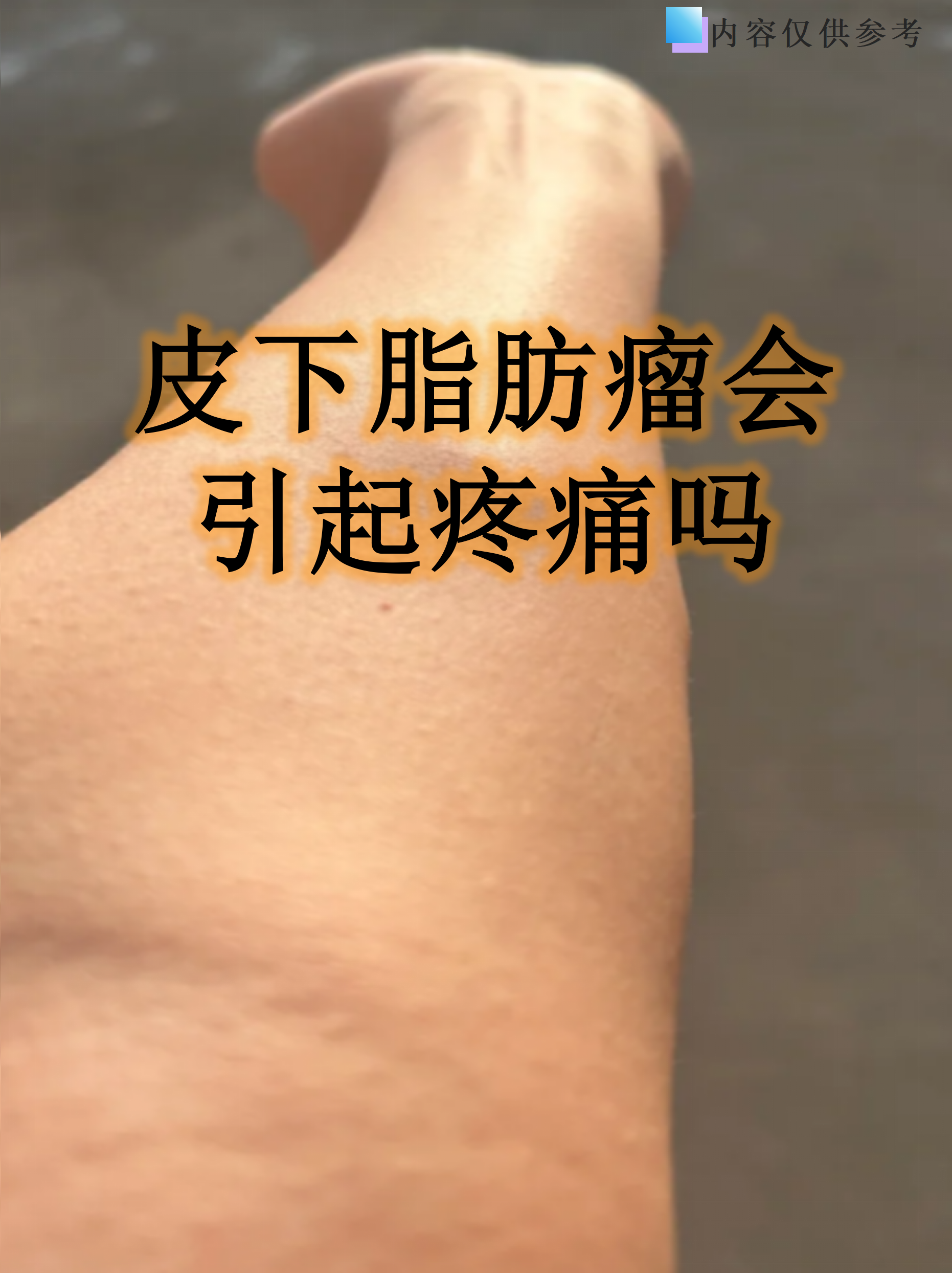 皮下脂肪瘤严重吗