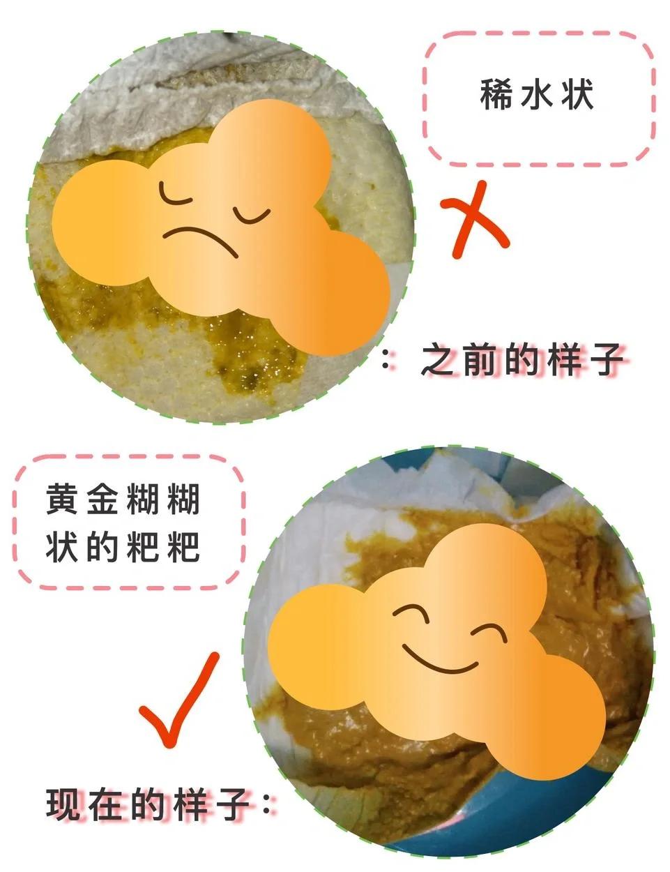 3个月婴儿拉稀怎么办