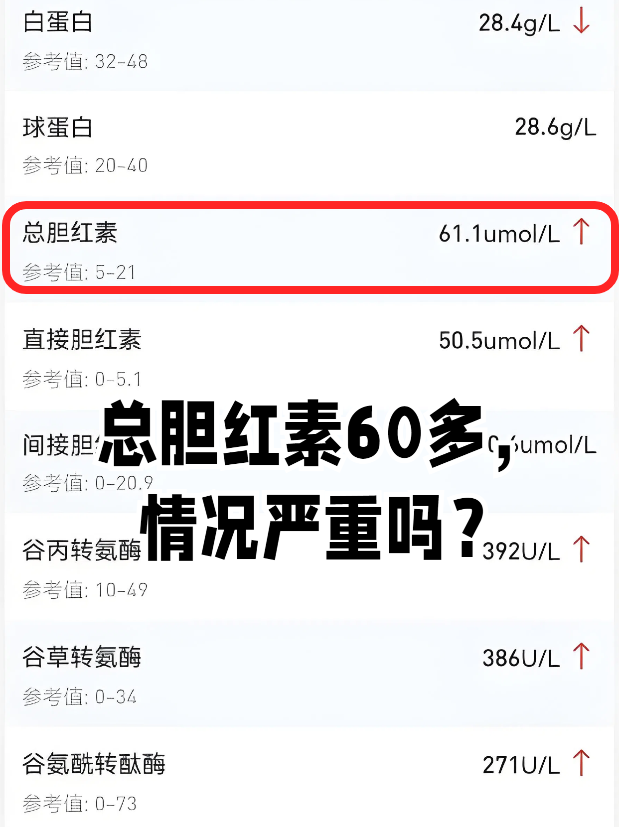 胆红素高怎么降下来