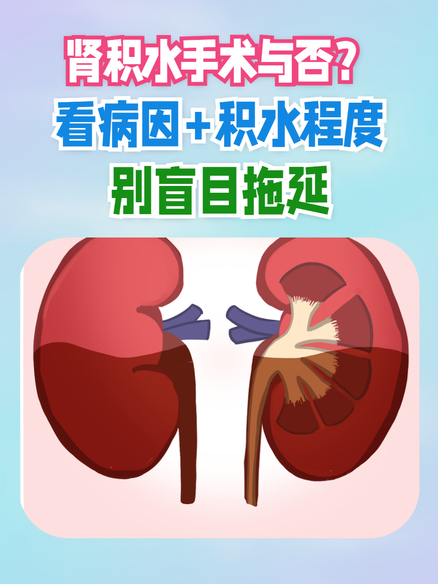 肾积水是什么原因引起的?