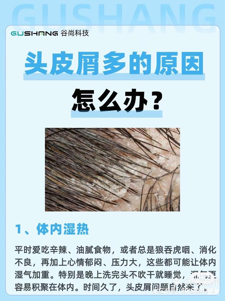 头皮屑太多,怎么办？