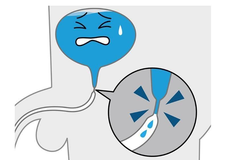 尿分叉会好的吗??会自愈吗