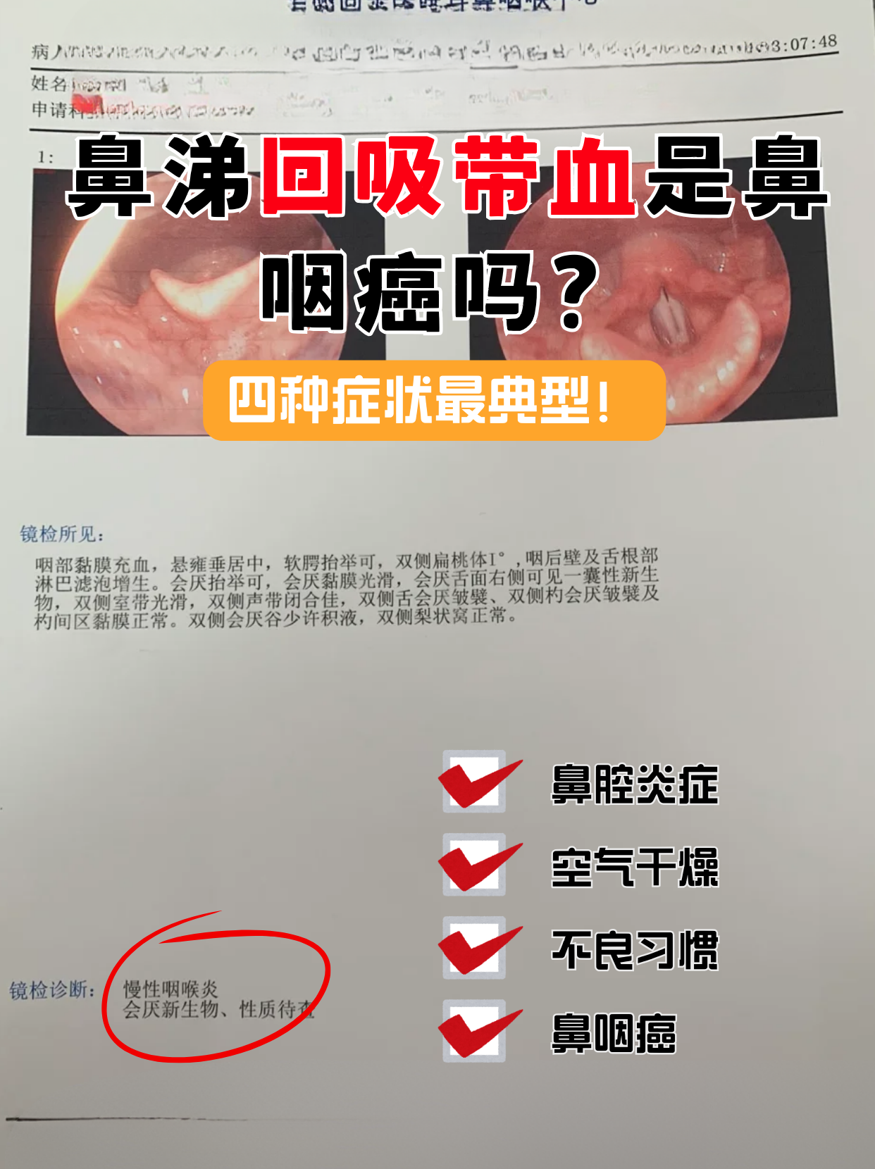 鼻炎会转变成鼻癌吗?