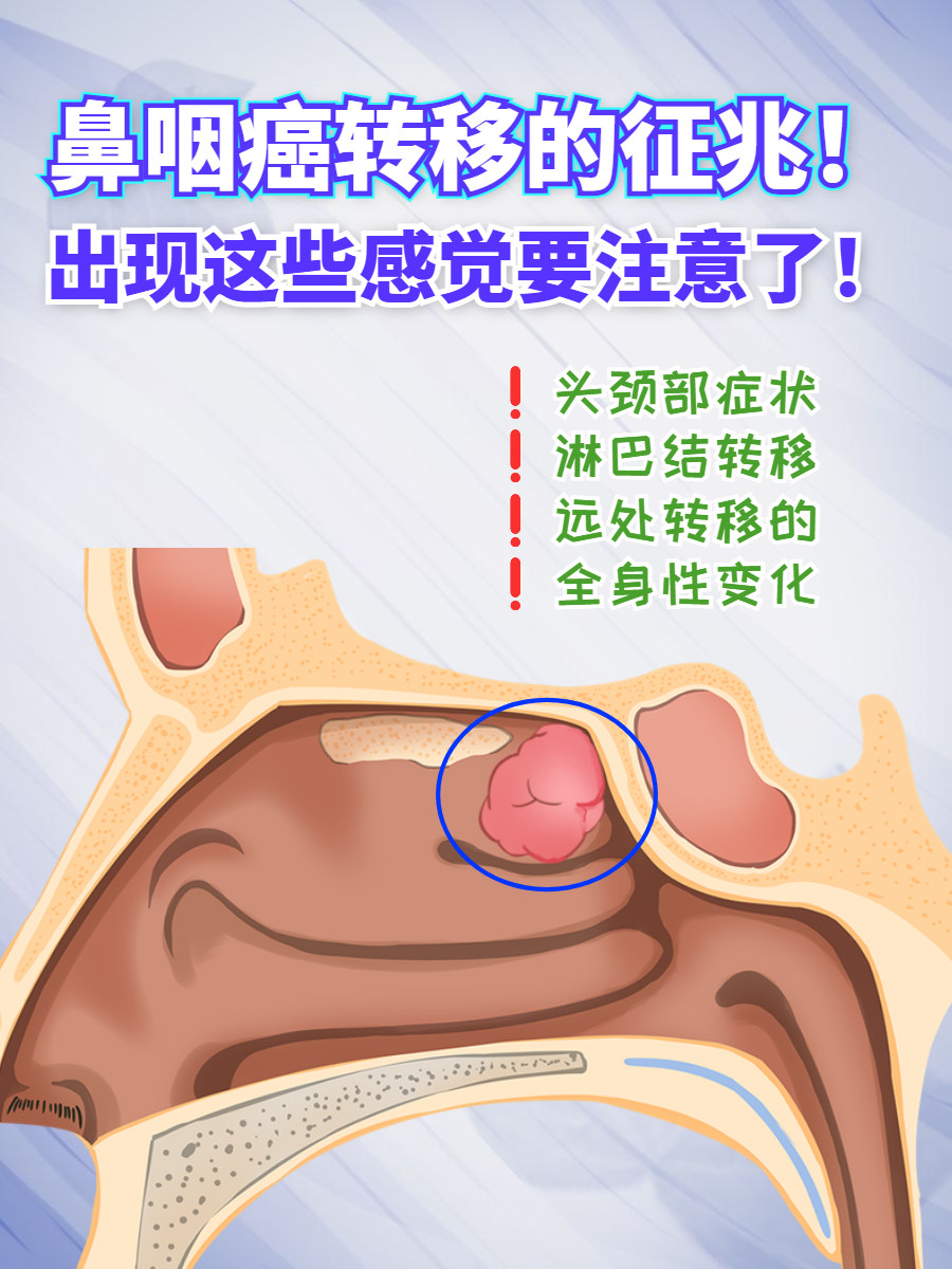 鼻炎会转变成鼻癌吗?