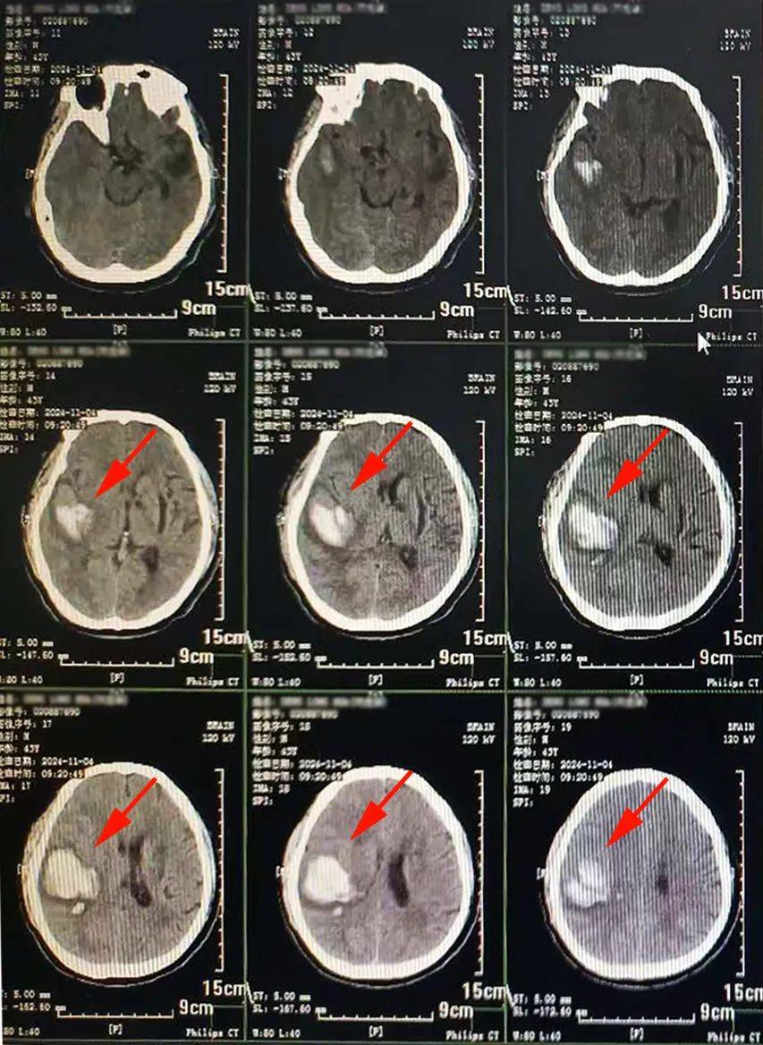 头部磁共振做一次大概多少钱?