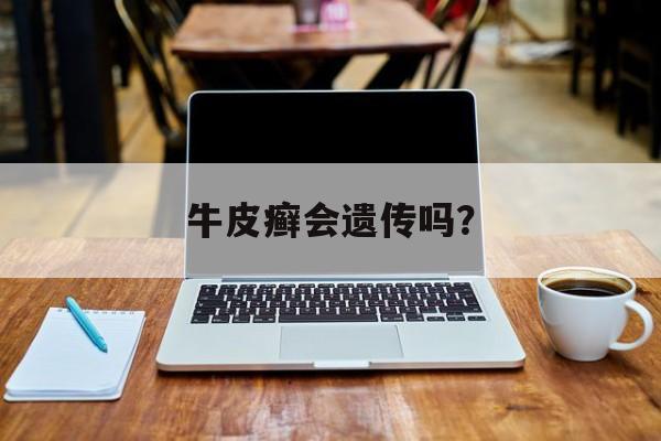 牛皮癣会遗传吗?
